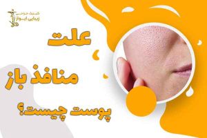 علت منافذ باز پوست چیست؟
